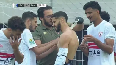 أحدهما في مفصل الكتف.. الزمالك يعلن طبيعة إصابة ثنائي الفريق في مباراة إنيمبا